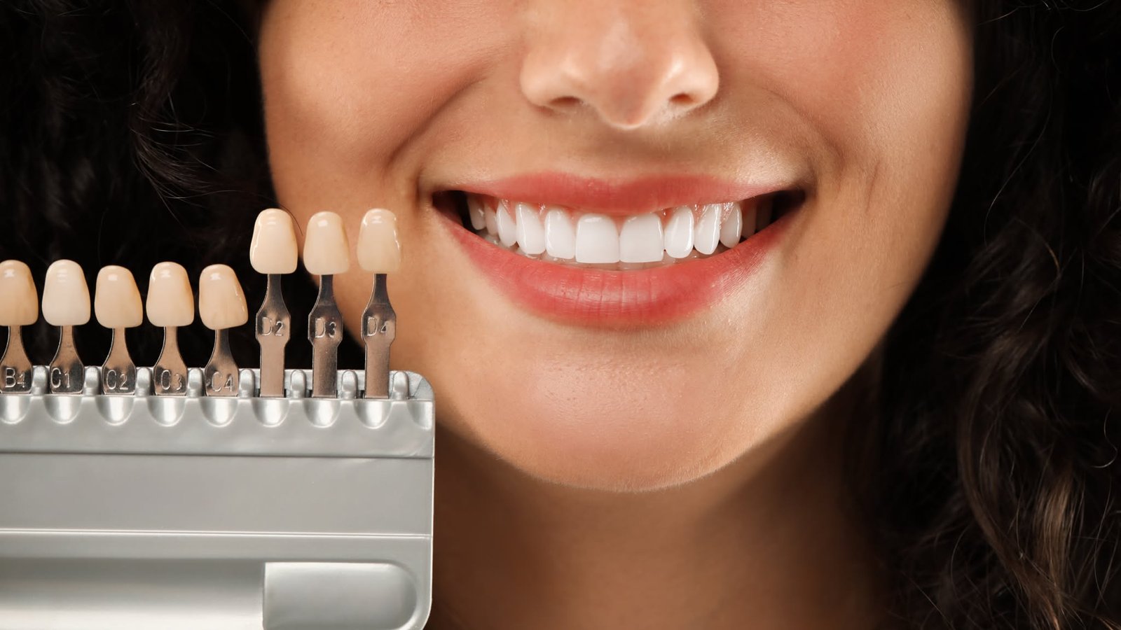 Smile beside a dental shade guide illustrating teeth whitening